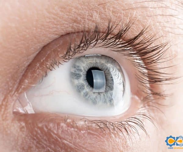 داربست کنام سلول های بنیادی